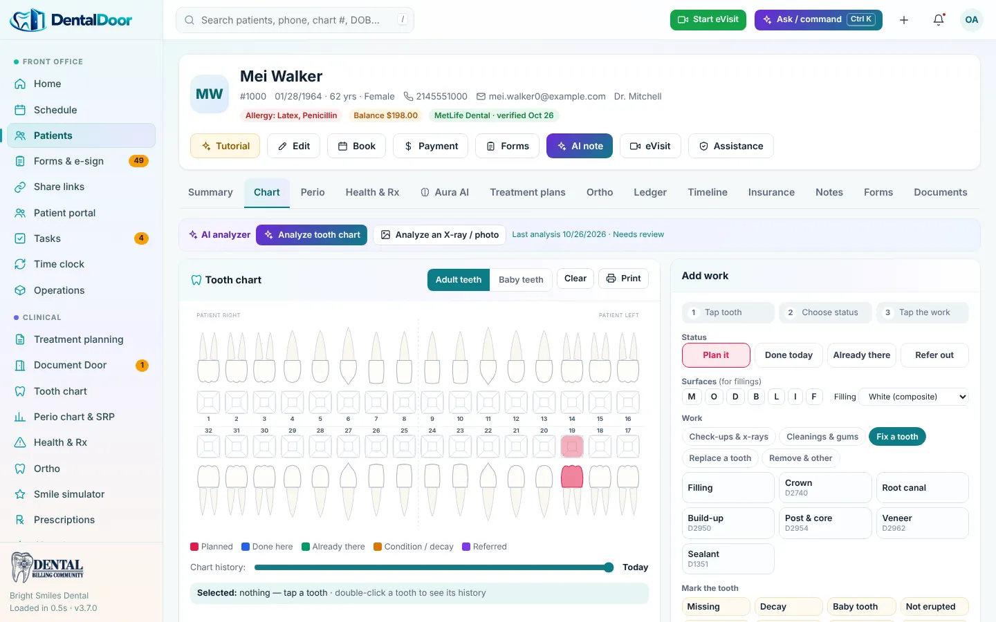 DentalDoor — Tooth chart that drives CDT codes (demo data)